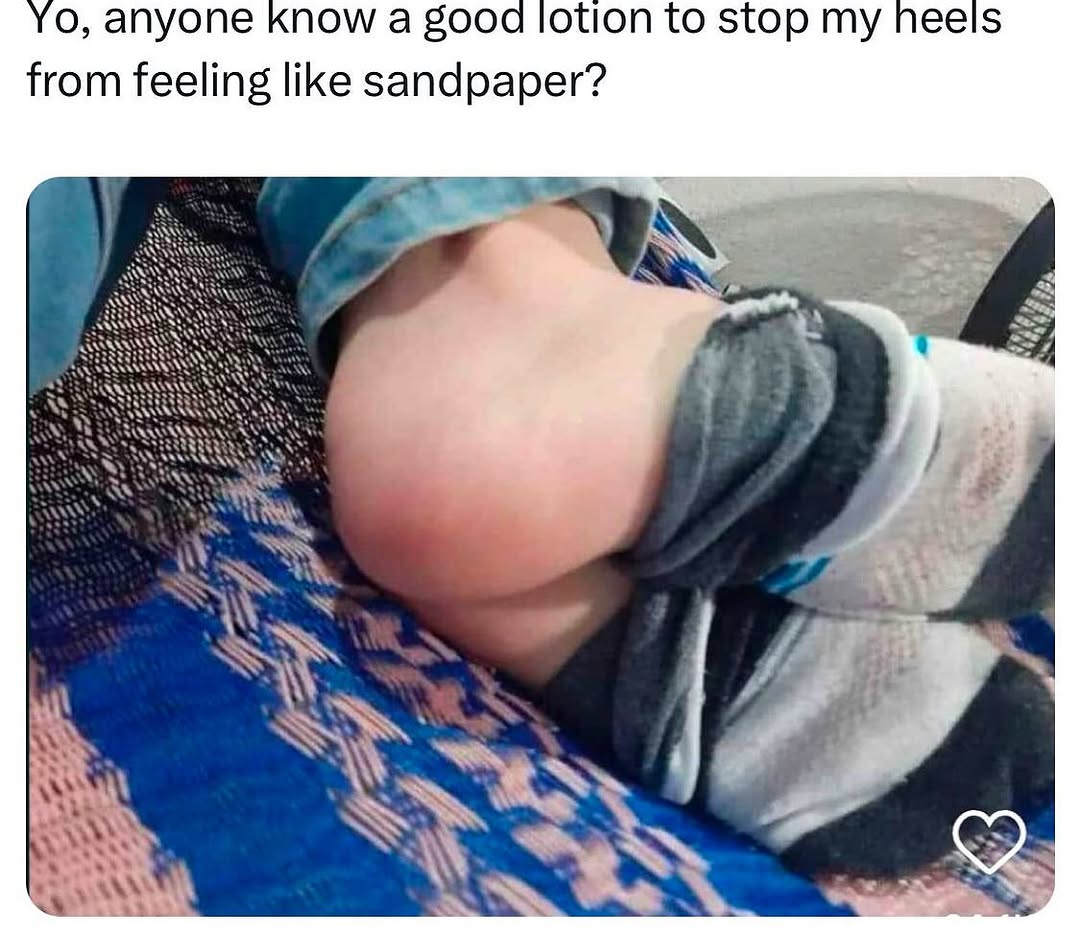 Kireçtaşı Olan Var mı?